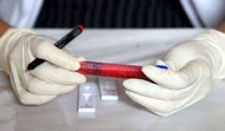 Rapid antigen tests may be used to rule-in COVID patients within first 5 days of illness: ICMR Study Rapid antigen tests may be used to rule-in COVID patients within first 5 days of illness: ICMR Study