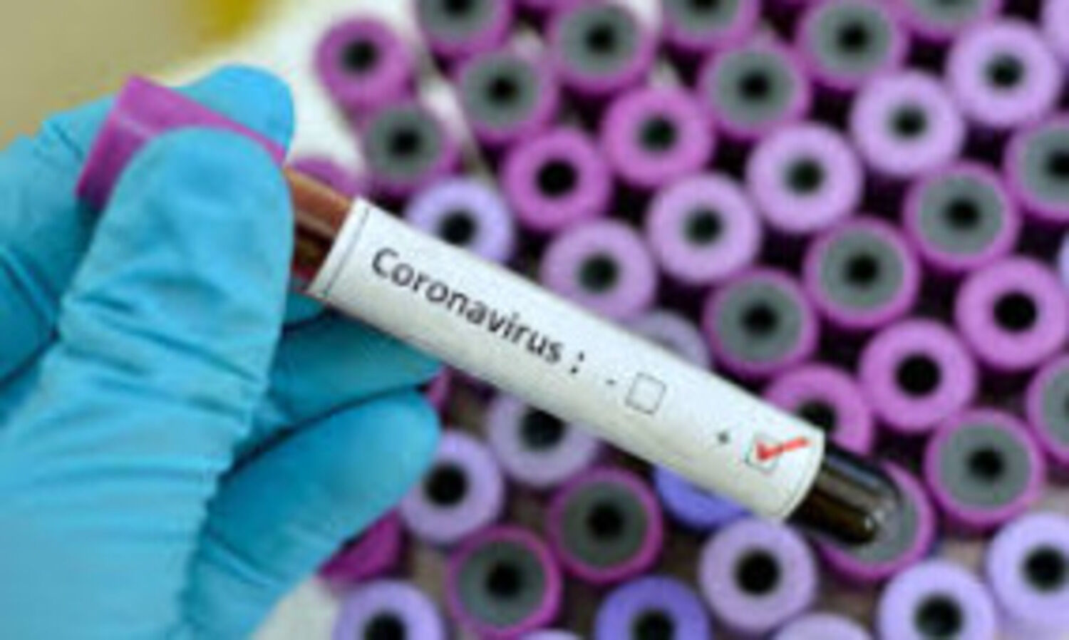 Arunachal reports 44 new COVID-19 cases, one more death