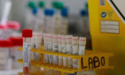 Experts: Bi-directional relationship between COVID-19 and diabetes Experts: Bi-directional relationship between COVID-19 and diabetes