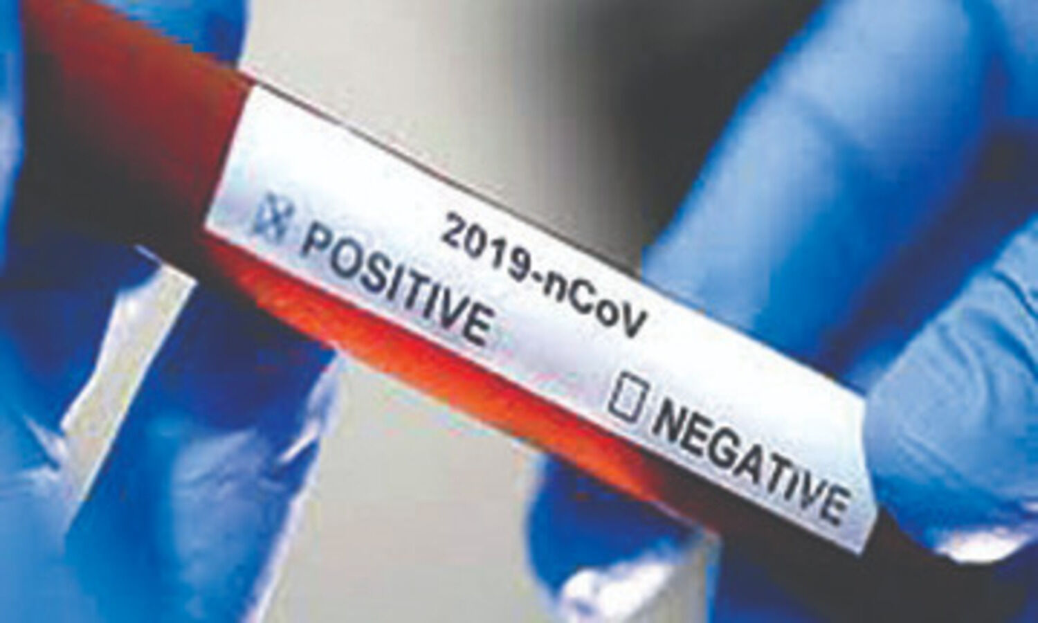Recovery rate goes up to 95.85%, 69,93,821 tests conducted till date