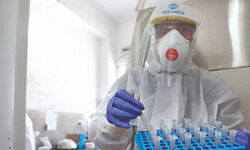 City sees 185 new cases, 315 recoveries, 9 deaths City sees 185 new cases, 315 recoveries, 9 deaths