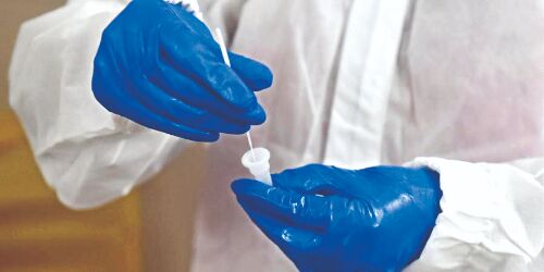 City records 536 fresh Covid cases, highest in 2.5 months