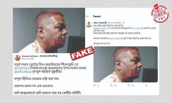 BJP sharing image of hurt jawan in Sitalkuchi incident fake