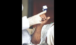 In moderate cases, anticoagulants, steroids are mainstays of treatment In moderate cases, anticoagulants, steroids are mainstays of treatment