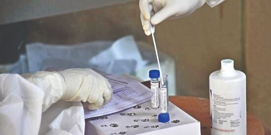 Capped rates of tests in pvt hosps not valid for corporates