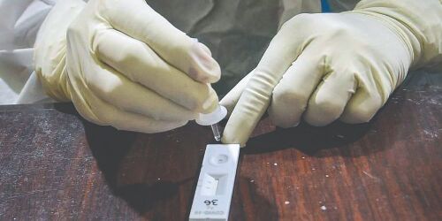 Cases dip to 557; 11 deaths reported in a day