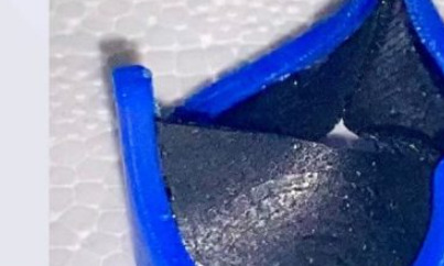 Chennai surgeon designs 3D printed heart valve Chennai surgeon designs 3D printed heart valve