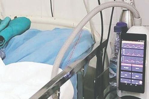 State allots Rs 10 crore to strengthen critical care infrastructure in govt hosps State allots Rs 10 crore to strengthen critical care infrastructure in govt hosps