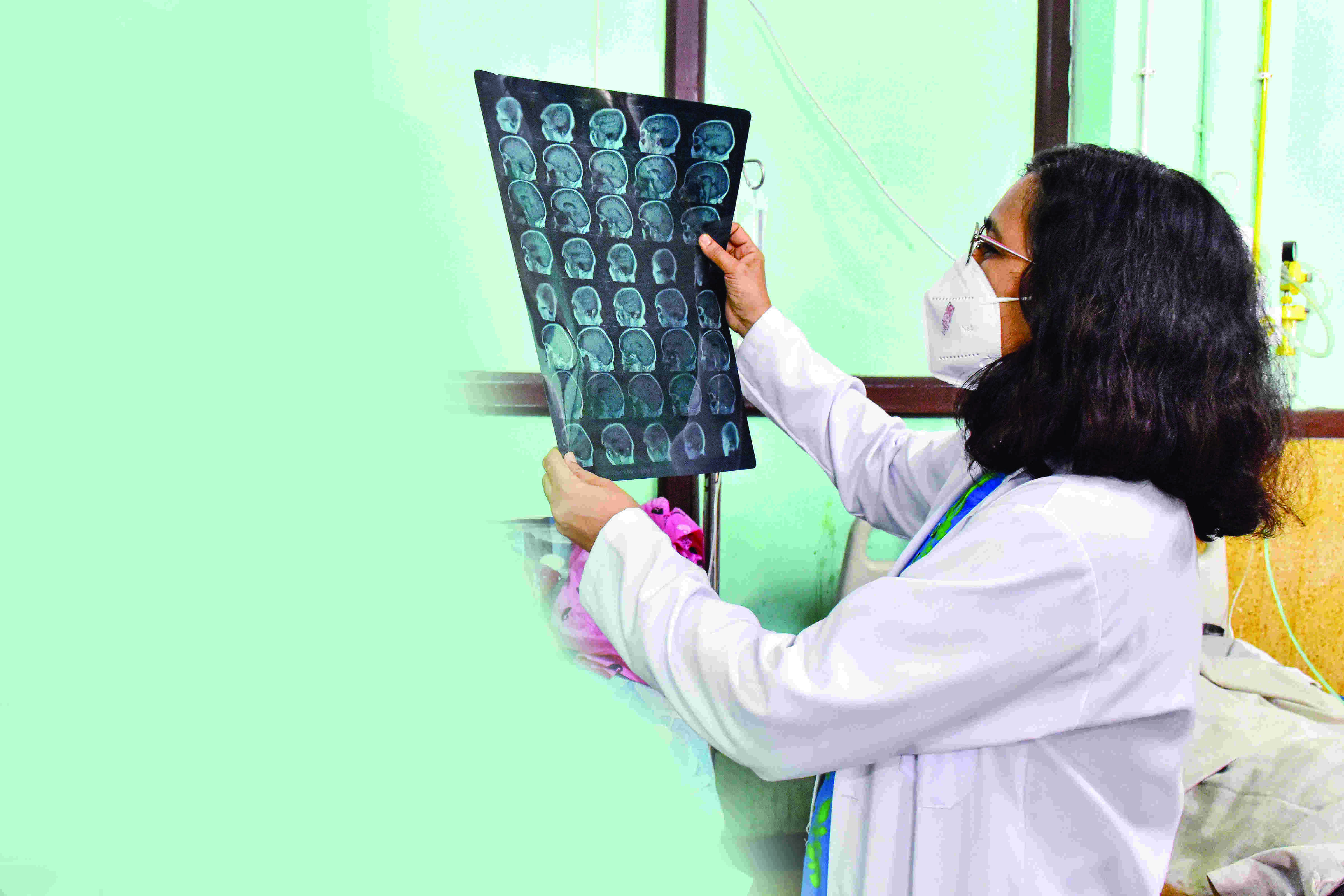 51,775 cases of mucormycosis reported in India: Centre 51,775 cases of mucormycosis reported in India: Centre