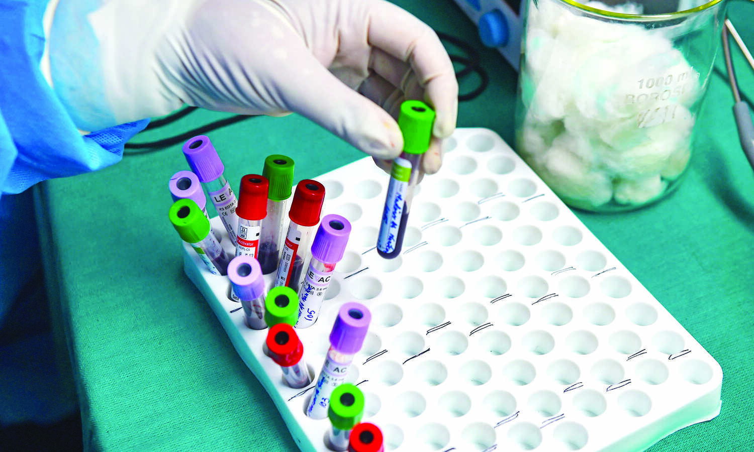 Omicron cases doubling in 1.5 to 3 days in areas with local spread: WHO