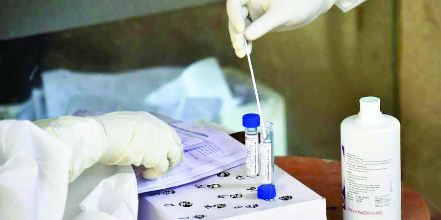 Health dept to conduct S-gene target failure test to detect Omicron cases Health dept to conduct S-gene target failure test to detect Omicron cases