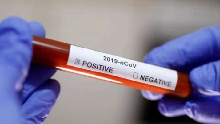 Vir Das tests negative for COVID-19