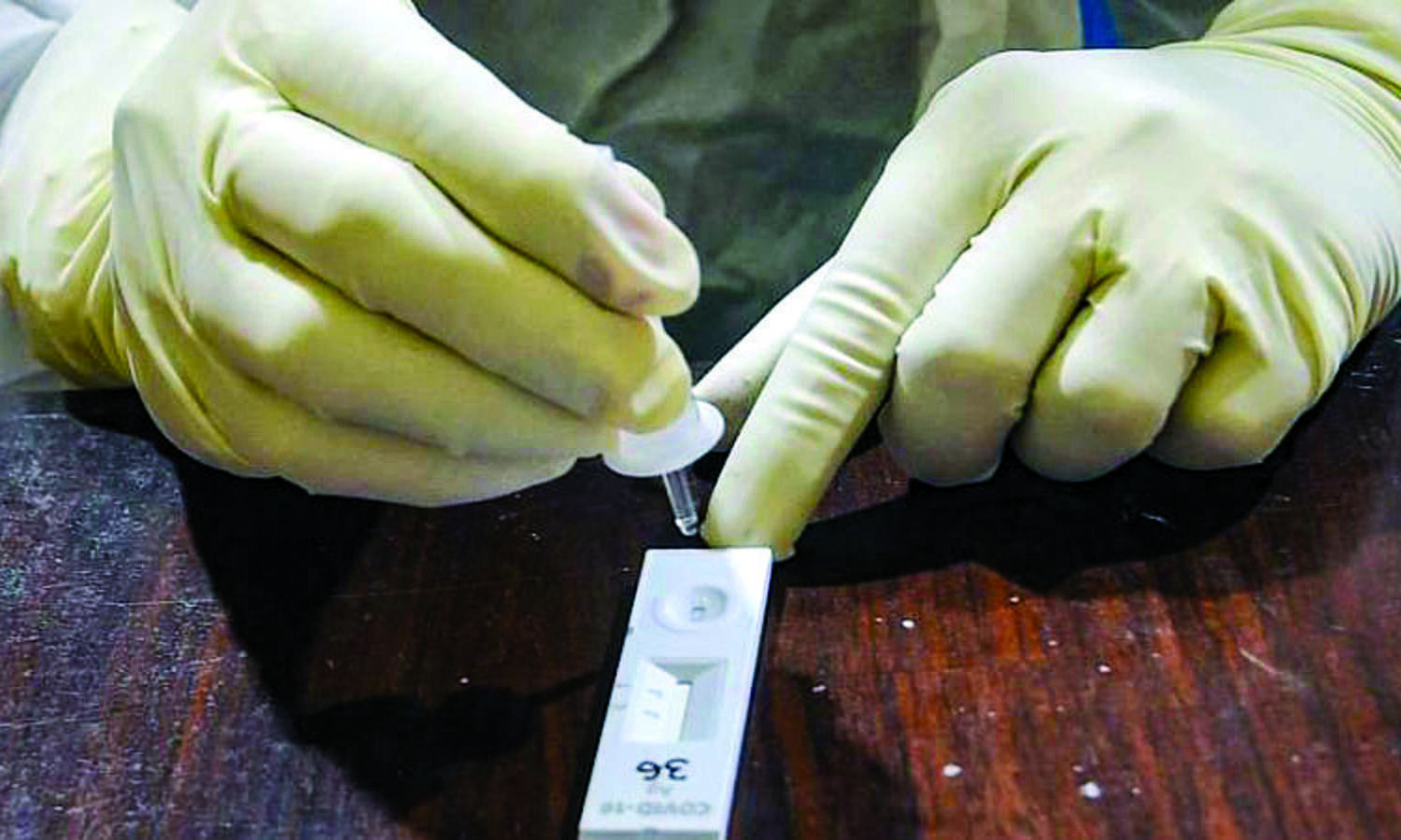 State records 1,523 cases; 35 deaths in a day