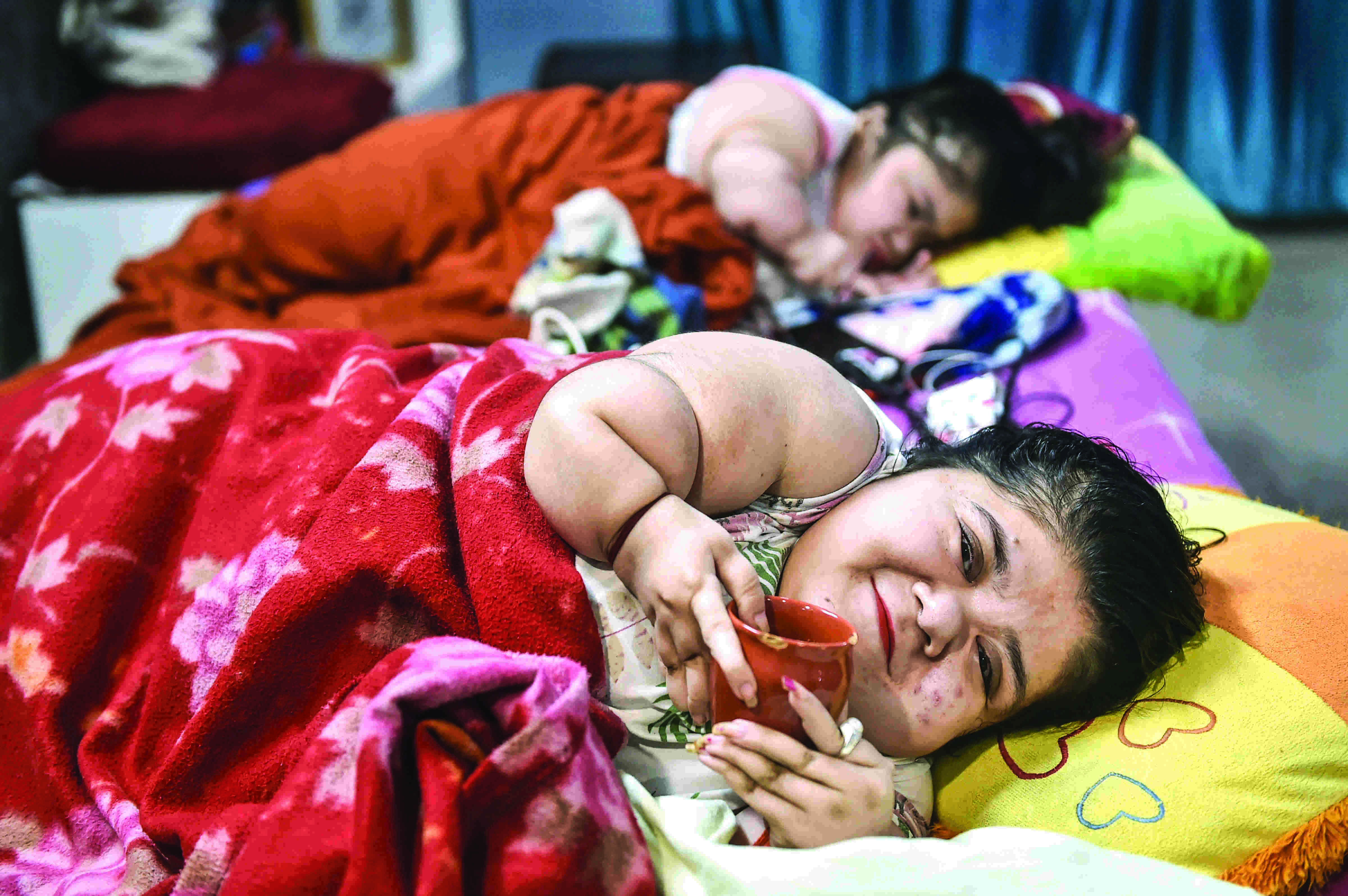 UP: Rare bone disease forces keen twins to skip voting this time