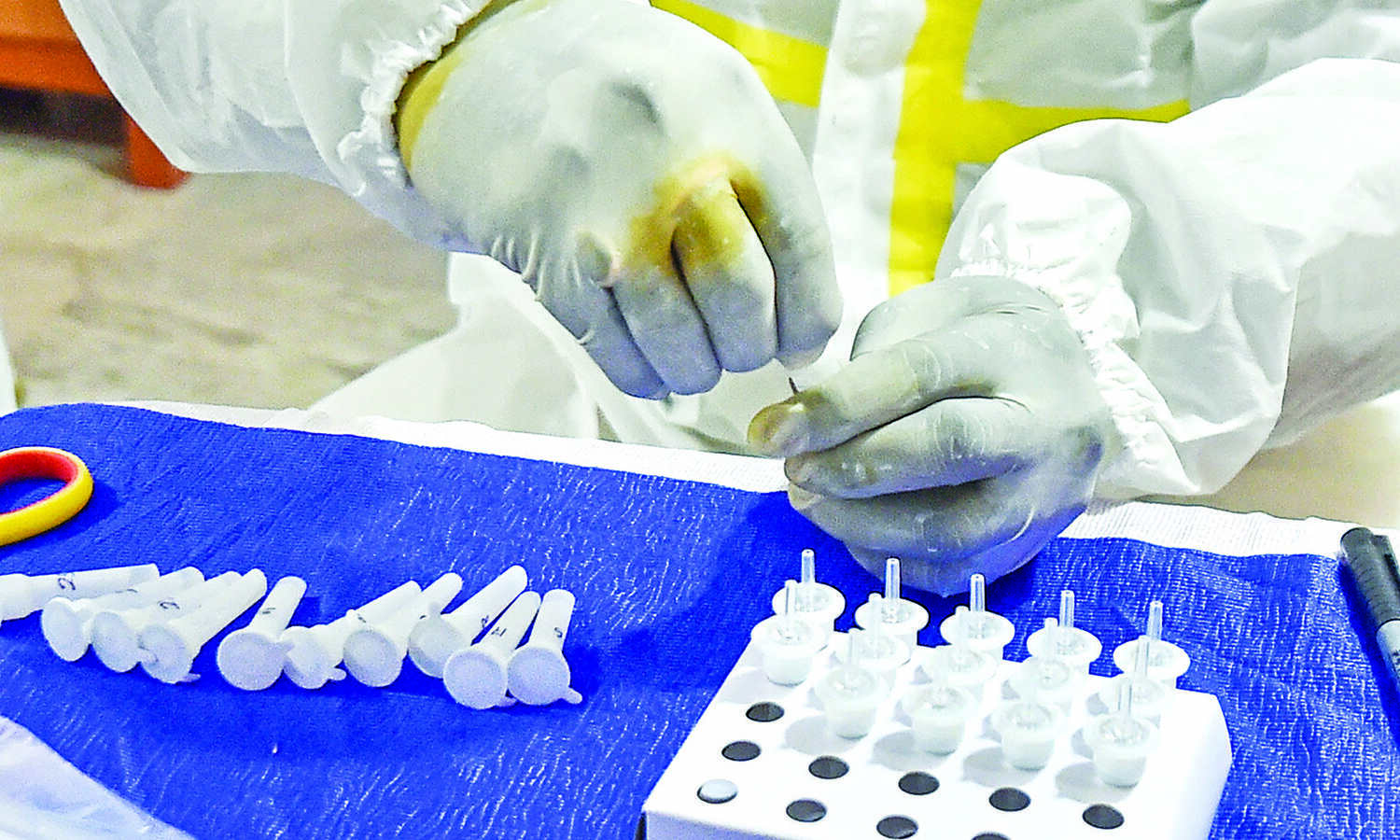 Coronavirus: India logs 3,714  new cases, seven fatalities