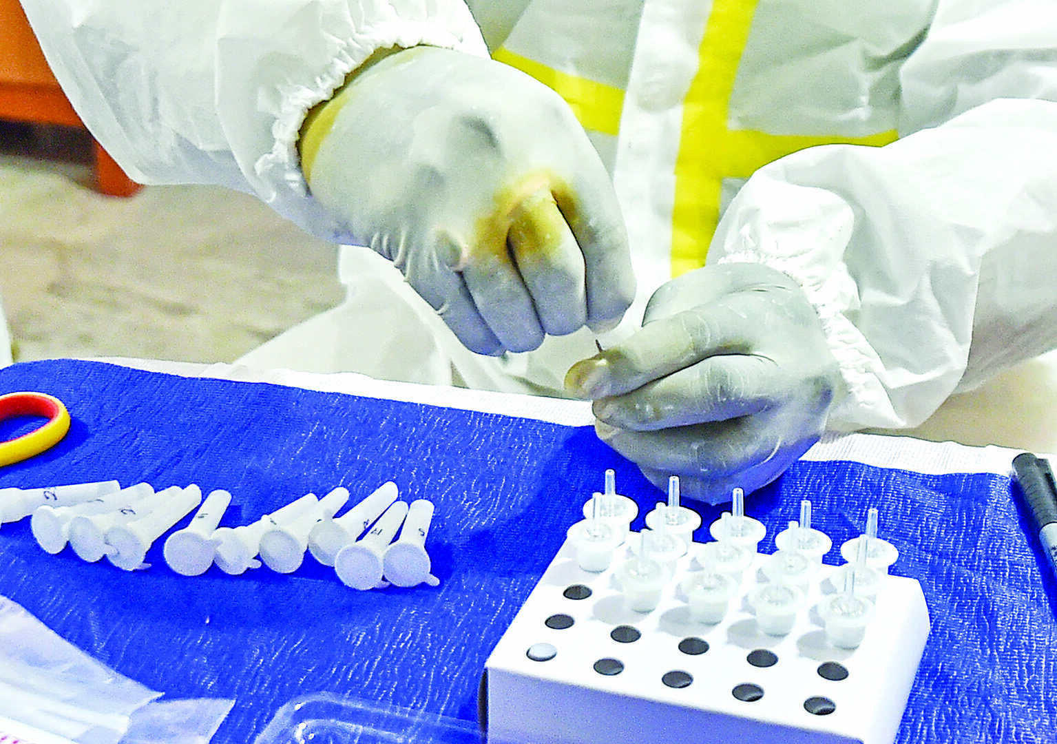 Coronavirus: India logs 3,714 new cases, seven fatalities Coronavirus: India logs 3,714 new cases, seven fatalities