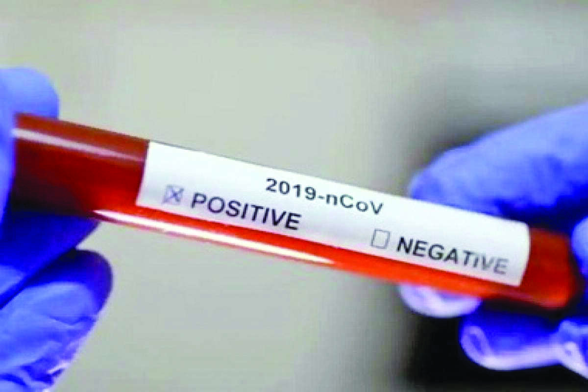 Genome sequencing must if CT value of Covid positive samples below 30 Genome sequencing must if CT value of Covid positive samples below 30