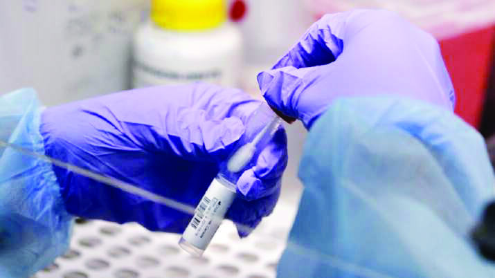 In a 1st, drainage water samples to undergo RT-PCR test In a 1st, drainage water samples to undergo RT-PCR test