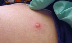 Fresh insights needed