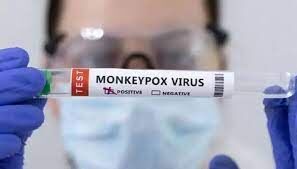 Monkeypox or Skin allergy: People rush to hospitals to check for symptoms Monkeypox or Skin allergy: People rush to hospitals to check for symptoms