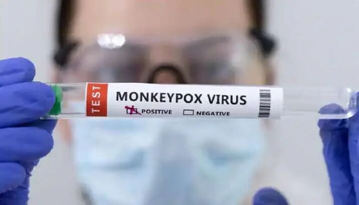 Indias first monkeypox death: Kerala youth had tested positive abroad Indias first monkeypox death: Kerala youth had tested positive abroad