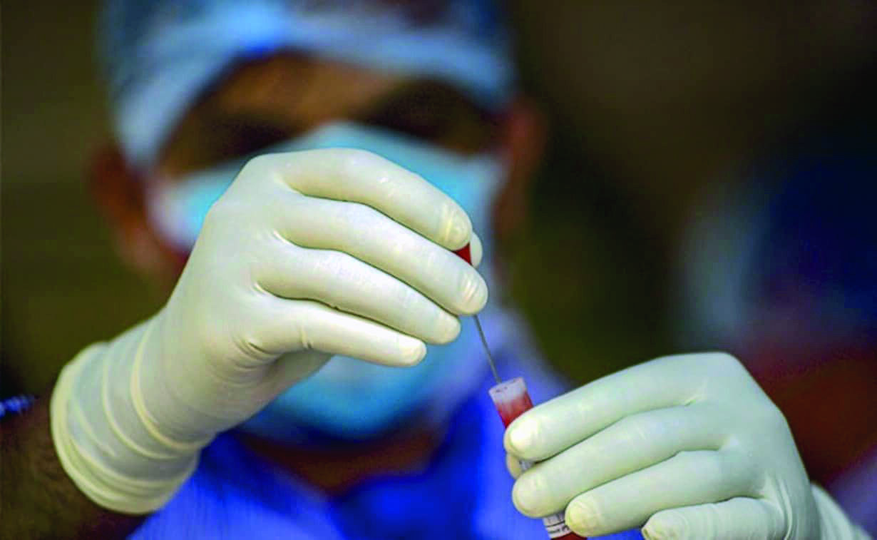 ICMR planning sero-survey among contacts of monkeypox patients ICMR planning sero-survey among contacts of monkeypox patients