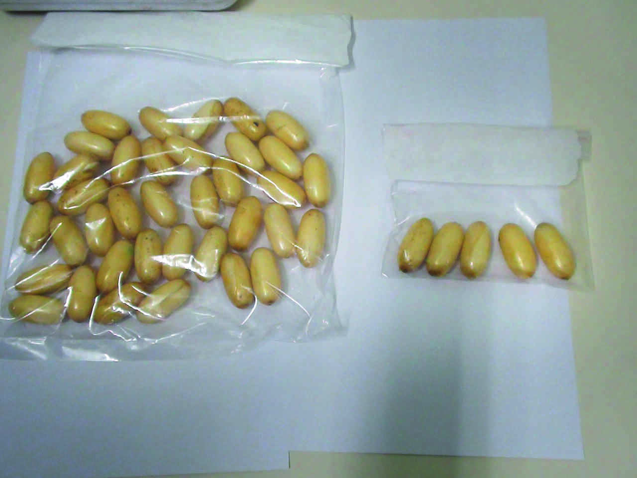 Brazilian native with cocaine capsules in stomach held in city Brazilian native with cocaine capsules in stomach held in city