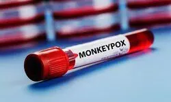 23 Confirmed Monkeypox Cases Reported In India Till Dec 8, 2022: Minister of State for Health Bharati Pravin Pawar