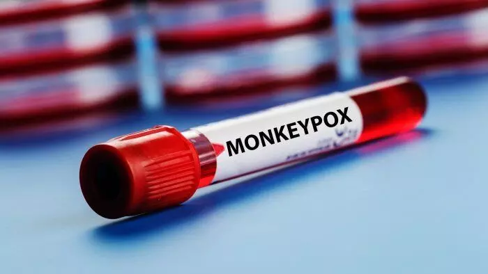 23 Confirmed Monkeypox Cases Reported In India Till Dec 8, 2022: Minister of State for Health Bharati Pravin Pawar