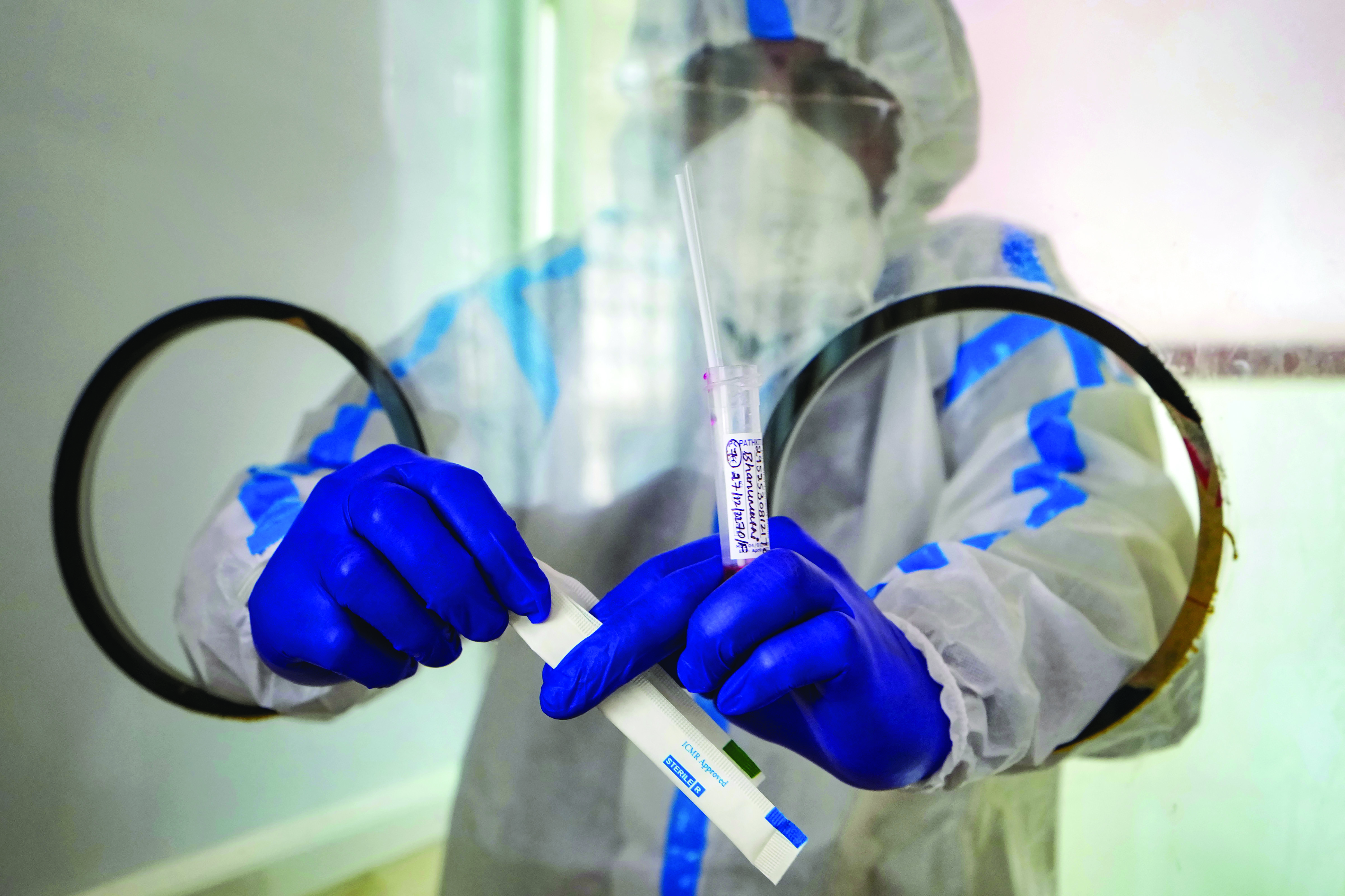 ‘Covid may impact semen quality in men’ ‘Covid may impact semen quality in men’