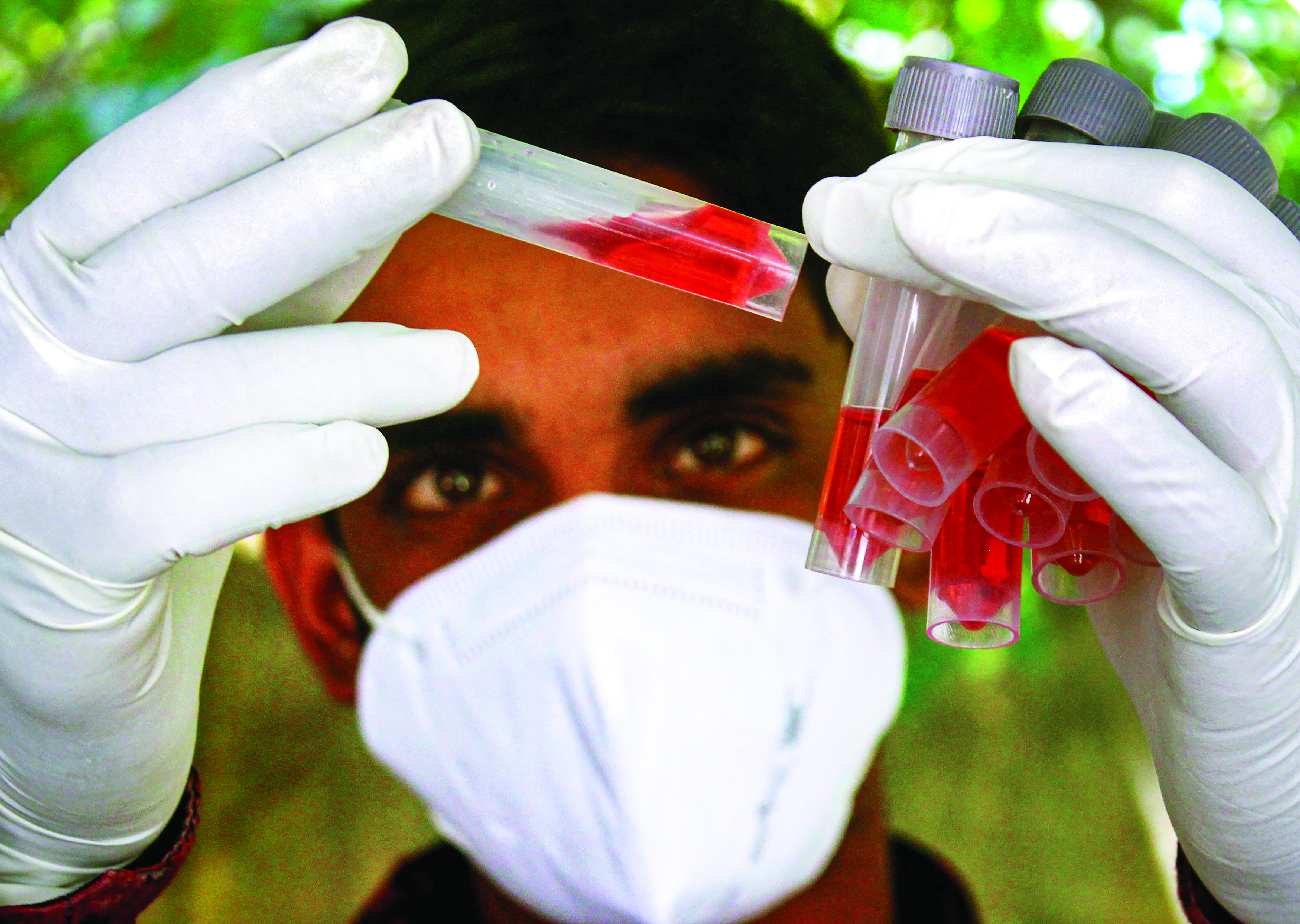 Capital reports 1,017 fresh Covid-19 cases, positivity rate soars to 32.25%