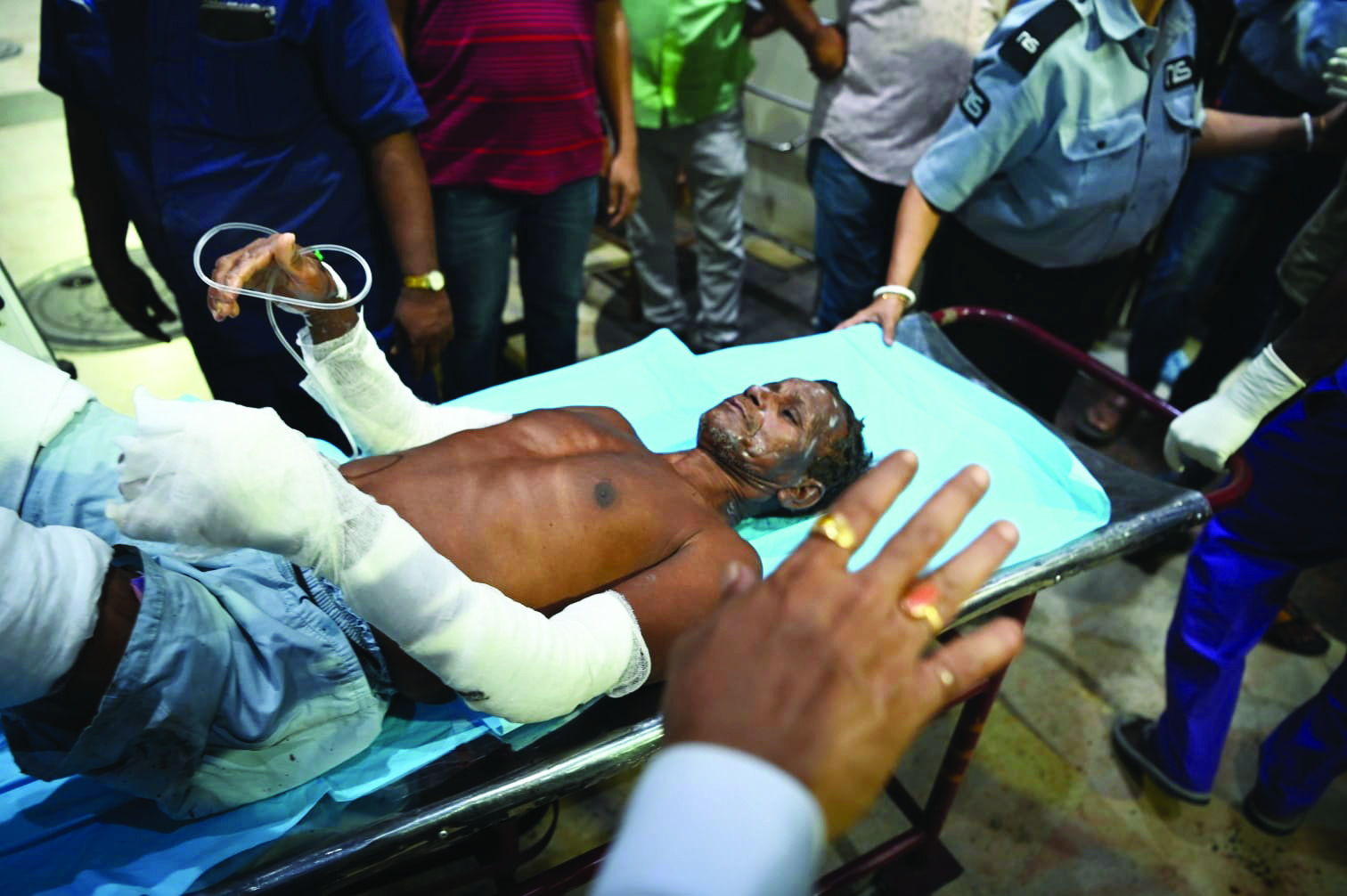 Garden Reach: 22 injured as 2 LPG cylinders blast in a flat Garden Reach: 22 injured as 2 LPG cylinders blast in a flat