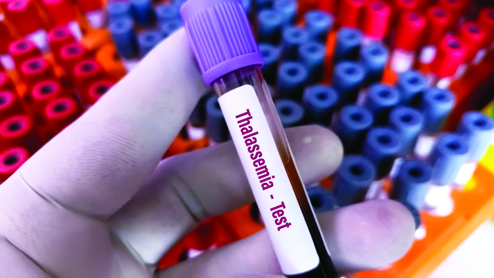 KMC opens its 13th knowledge hub, dedicates it to Thalassemia