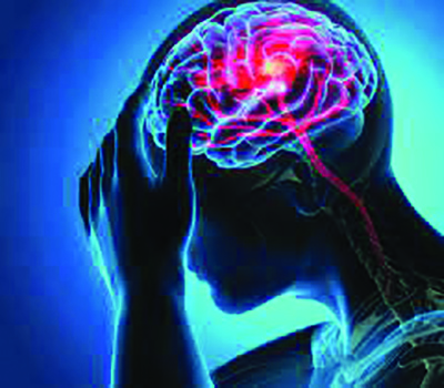 37% rise in incidents of stroke from 1990 to 2019