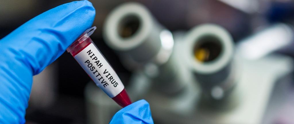 Results of samples from Kerala sent to virology institute in Pune awaited to confirm presence of Nipah virus Results of samples from Kerala sent to virology institute in Pune awaited to confirm presence of Nipah virus