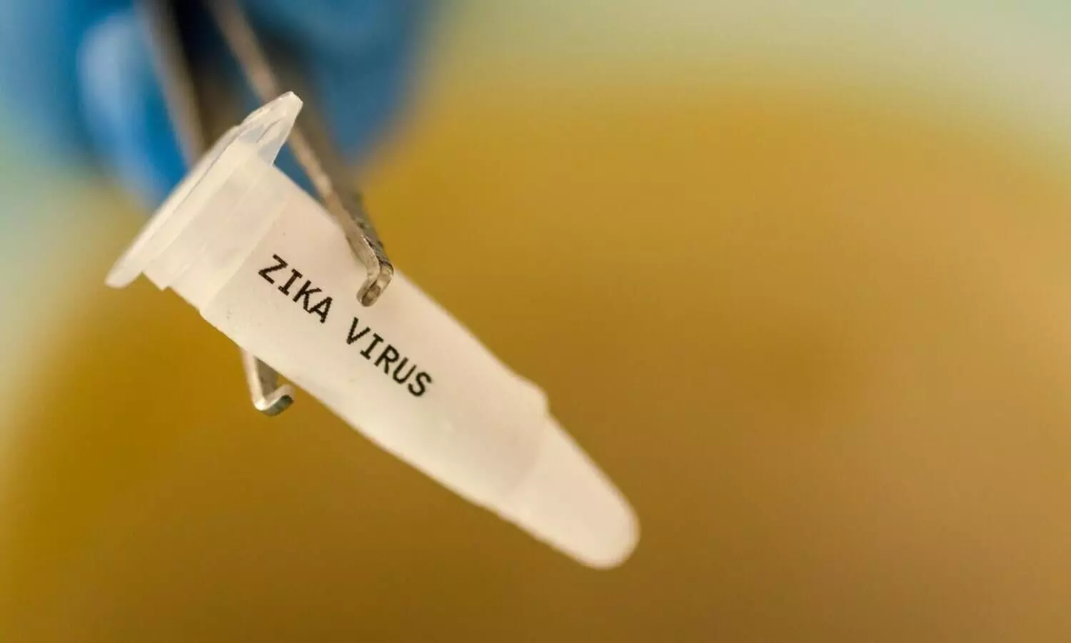 Union Health Ministry issues Zika virus alert amid Maharashtra cases