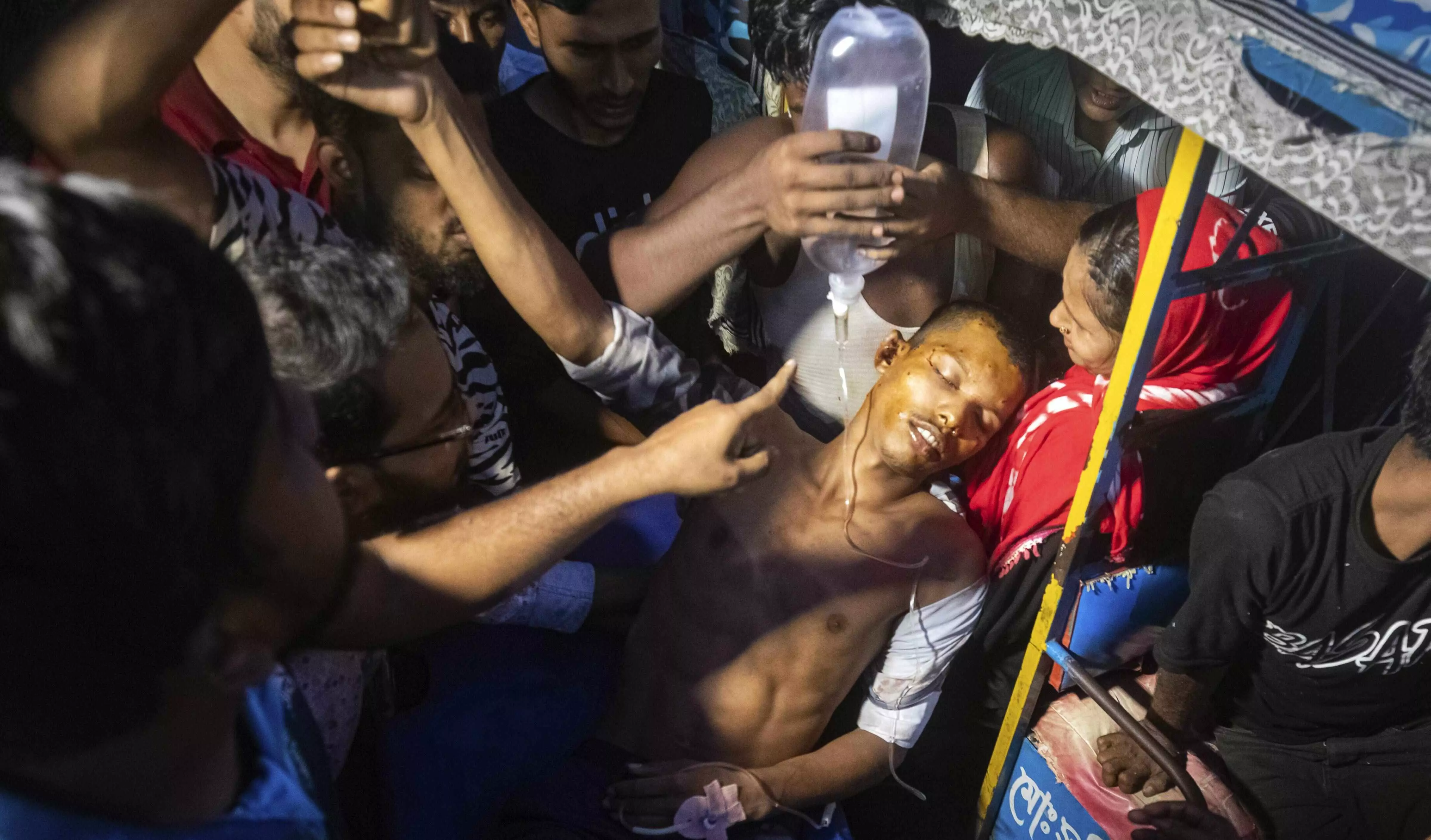 Unrest impacts patient footfall from Bangladesh in Kolkata hospitals Unrest impacts patient footfall from Bangladesh in Kolkata hospitals