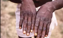 Threatening resurgence