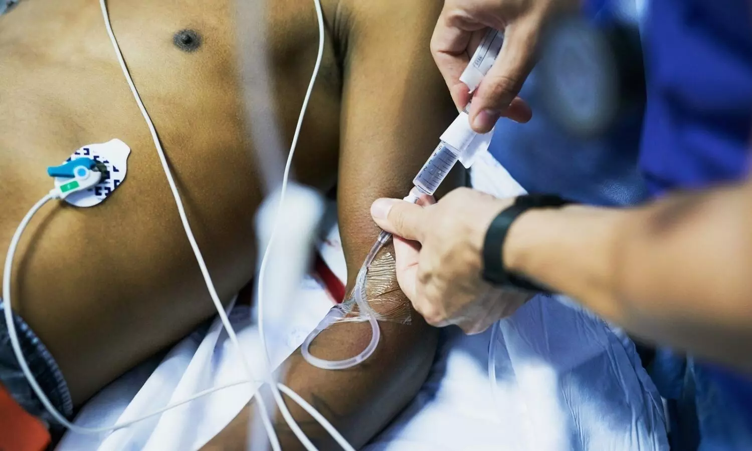 It is not practical: SC dismisses plea for mandatory drug side effects disclosure to patients