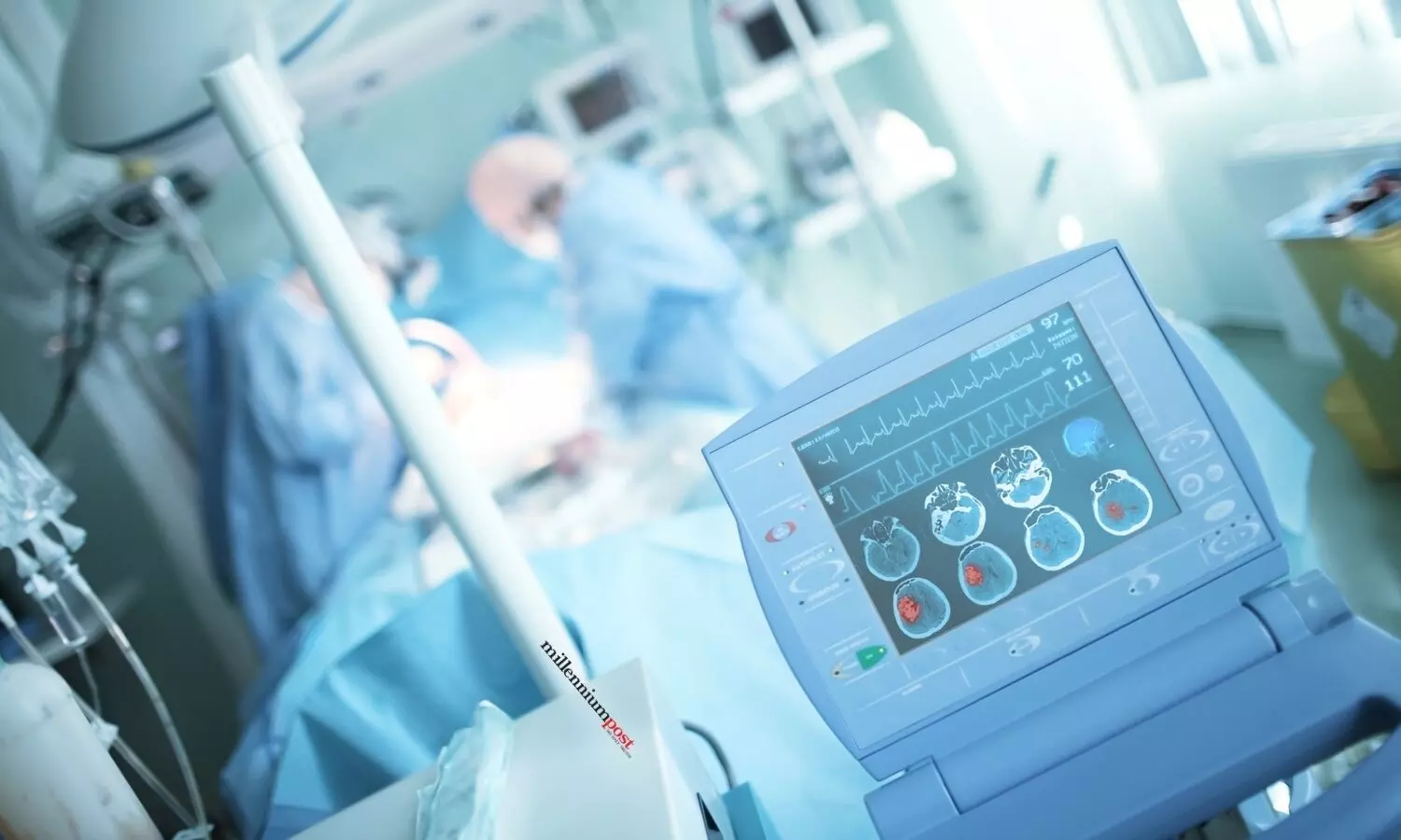 Study estimates about a quarter of Indian population can access stroke facility in an hour