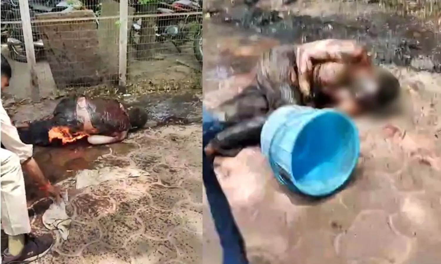 Man set himself on fire in Bhopal, admitted to hospital with over 40% burn injuries