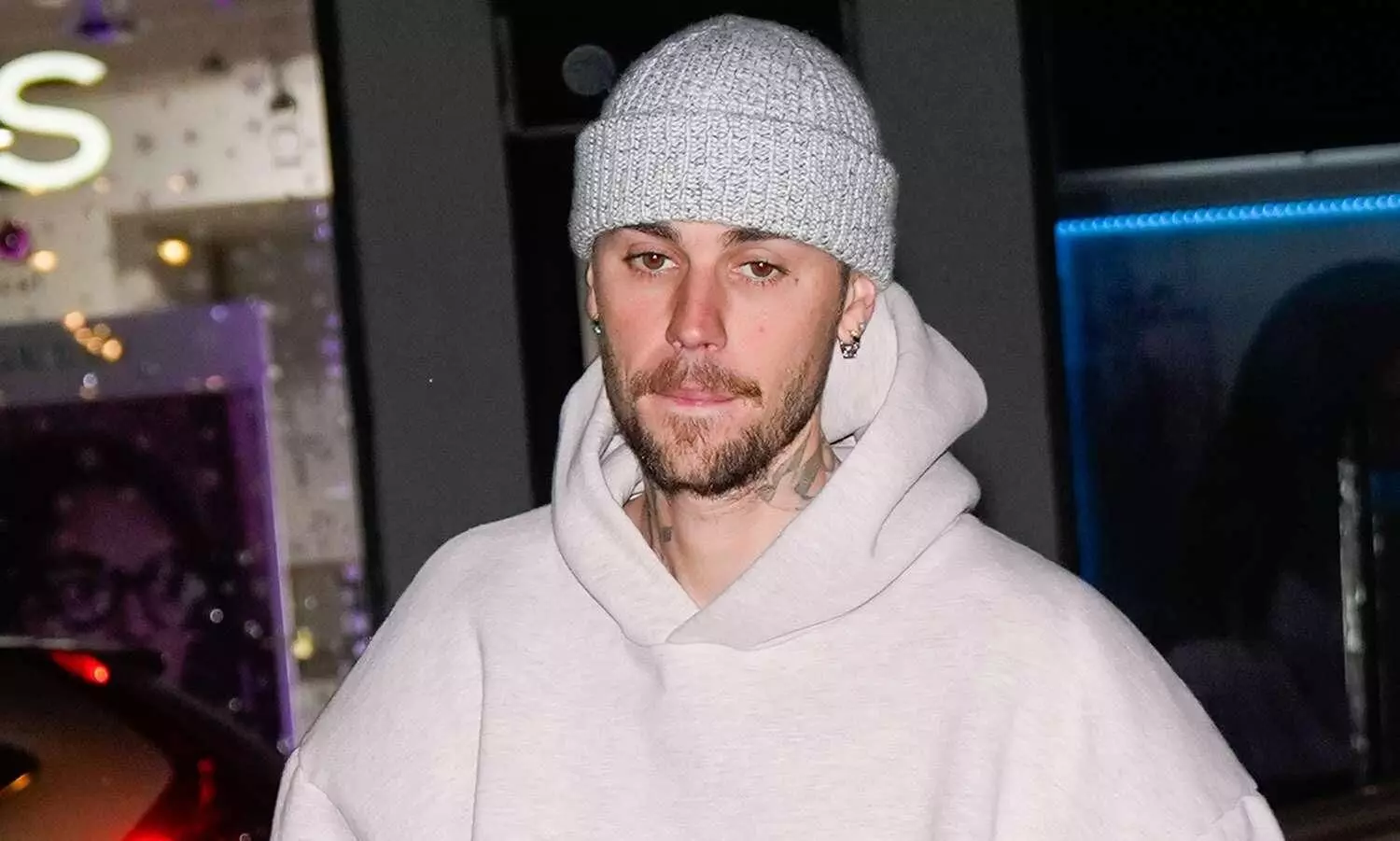 Justin Bieber admits having anger issues: I am broken Justin Bieber admits having anger issues: I am broken