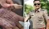 Accused named by woman doctor in her suicide note written on palm arrested from Pune Accused named by woman doctor in her suicide note written on palm arrested from Pune