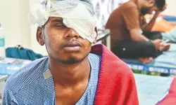 Diwali eye injuries up 19%, says AIIMS