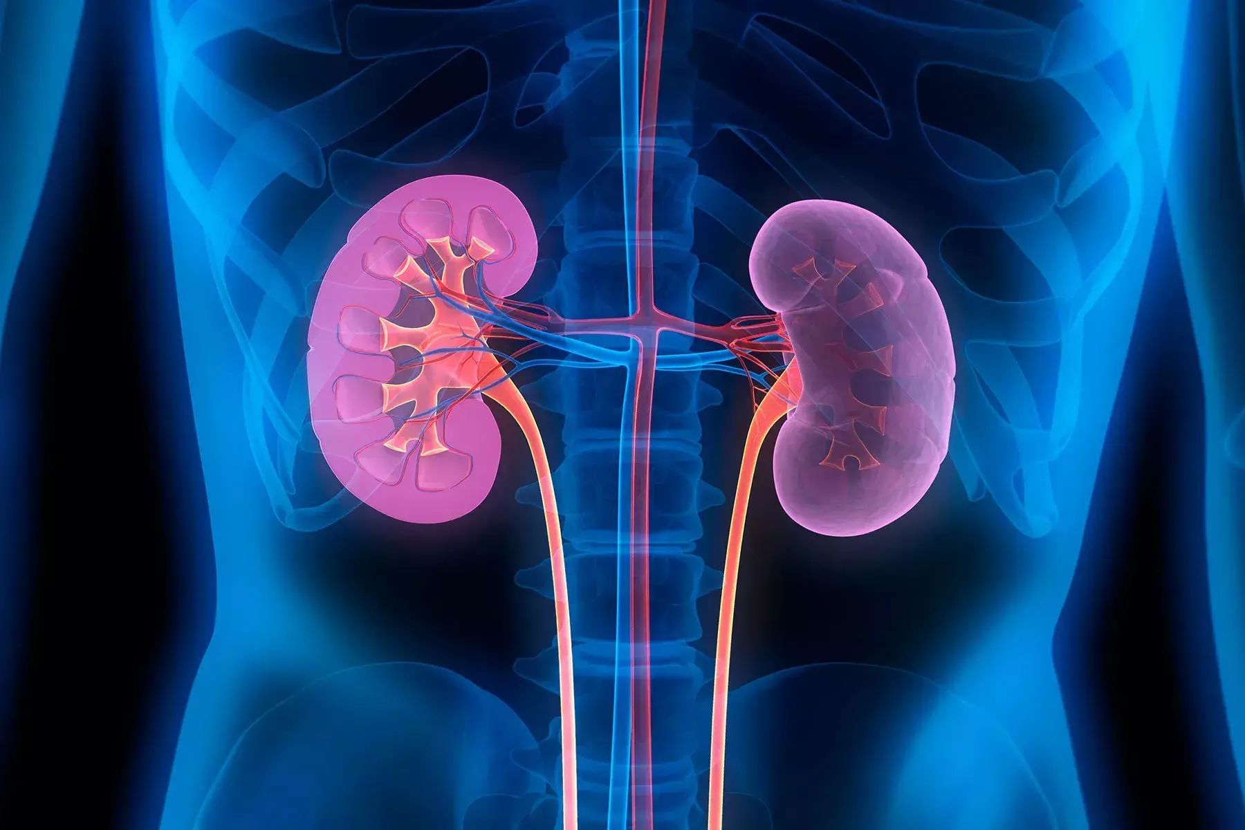 Global study estimates India had second highest chronic kidney disease cases in 2023 Global study estimates India had second highest chronic kidney disease cases in 2023