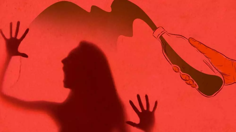 SC seeks details of all acid attack trials in country after noting pendency of 16-yr-old acid attack trial SC seeks details of all acid attack trials in country after noting pendency of 16-yr-old acid attack trial