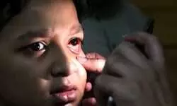 Air pollution increases risk of eye infection, other ocular problems, say doctors