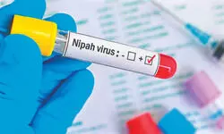 ‘No active Nipah infection   found in Bengal bats survey’