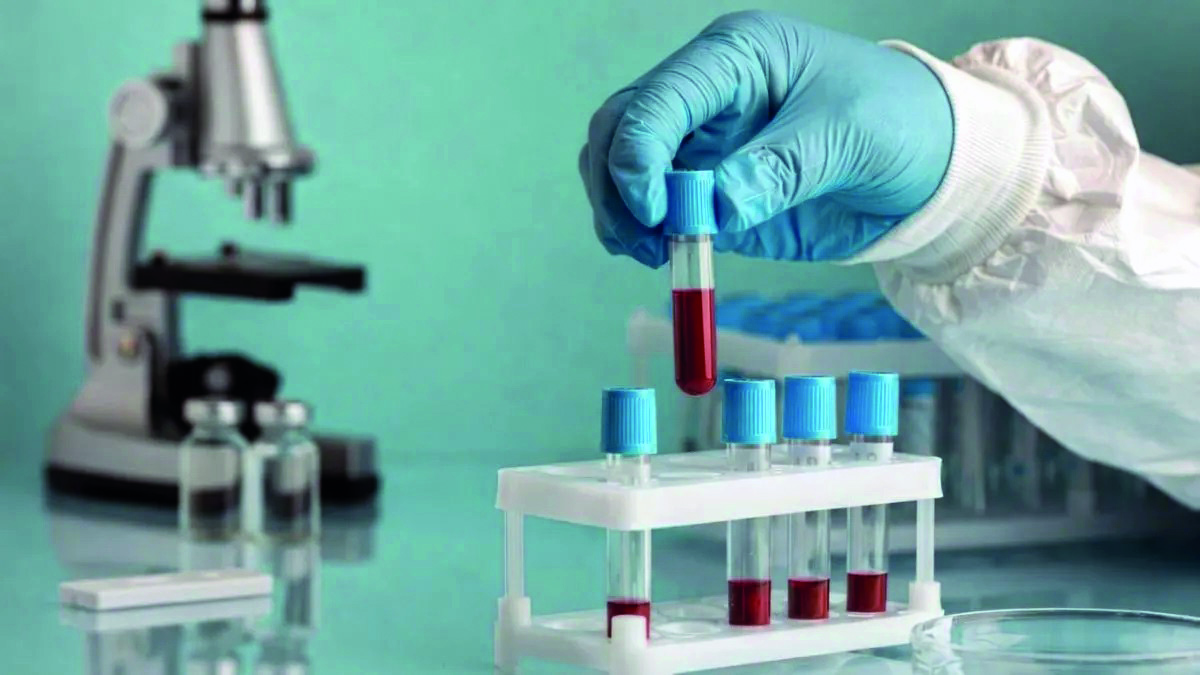 Nipah check: RT-PCR tests conducted on bats at Alipore Zoo