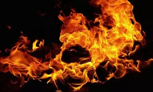 Haryana: 11 injured as fire breaks out after gas cylinder leak at residential quarter in Yamunanagar Haryana: 11 injured as fire breaks out after gas cylinder leak at residential quarter in Yamunanagar